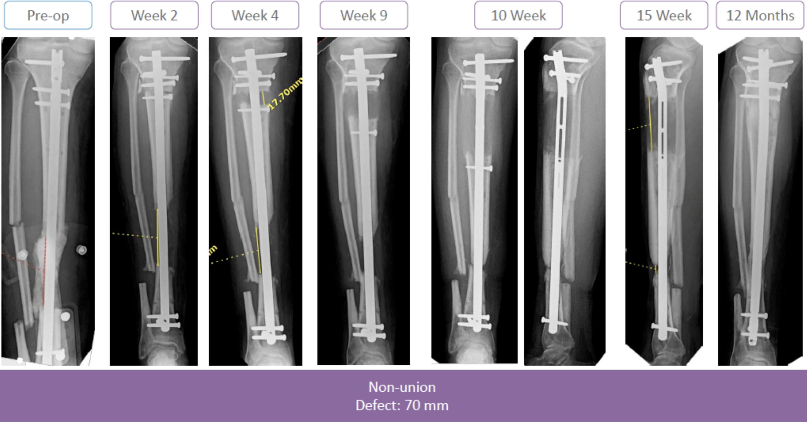 Screen Shot 2020-08-04 at 3.24.33 PM