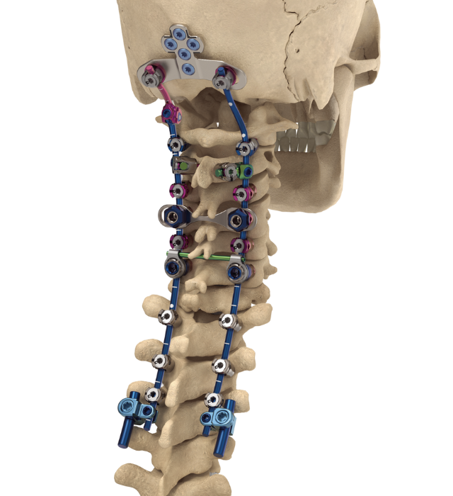 C360 - Cervical procedural solutions - NuVasive C360 - Cervical procedural solutions - NuVasive